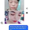 dưỡng dài mi feg chính hãng