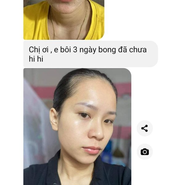 serum peel da tái tạo da cổ mộc lan