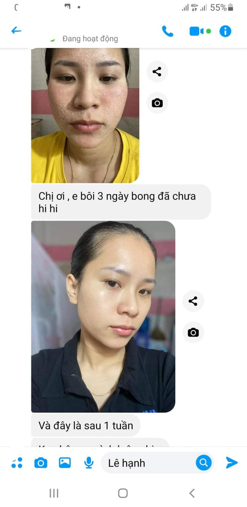 serum peel da tái tạo da cổ mộc lan