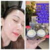 BỘ ĐÔI KEM QLANXL DƯỠNG TRẮNG DA VÀ TRỊ NÁM TÀN NHANG 35G HÀN QUỐC - mỹ phẩm trị nám tốt nhất