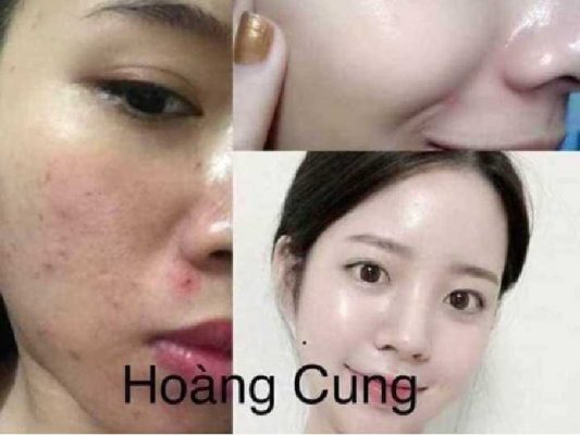 feed back của khách hàng - phản hồi sau khi sử dụng kem hoàng cung hồng vip