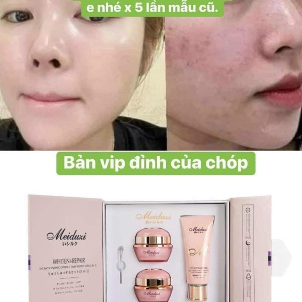 bộ mỹ phẩm Meiduzi hồng 3 món